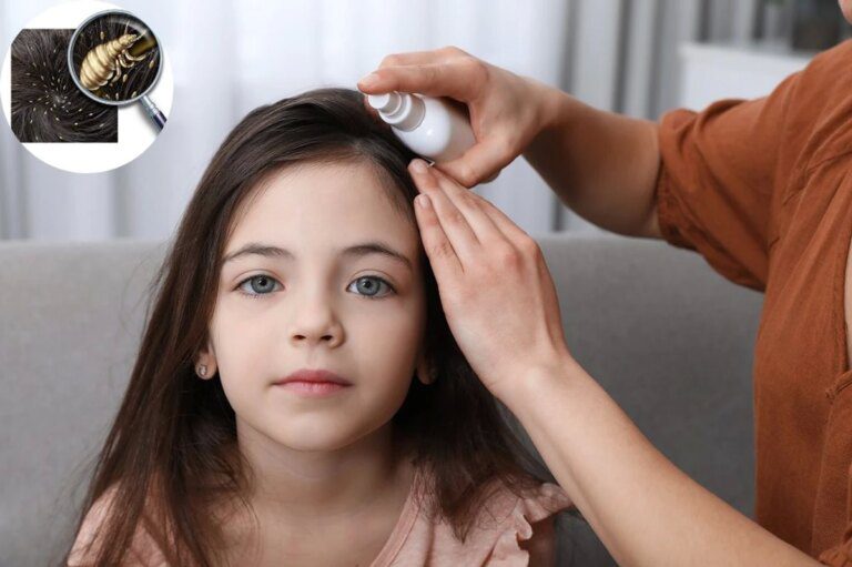 What to do when the child comes home with lice in his hair