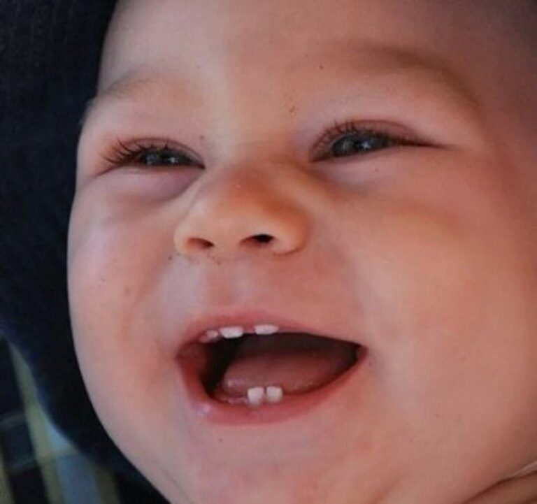 How do you help the baby when his first teeth grow